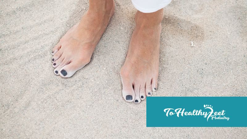 3 Essential Foot Care Tips for Managing Bunion Pain